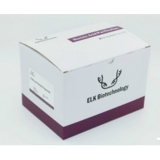 EP015-50T Набор для выделения плазмидной ДНК без эндотоксинов Endo-Low Plasmid Prepare Kit, 50 реакций, ELK Biotechnology